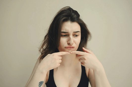 Pourquoi mon acné revient toujours au même endroit ?