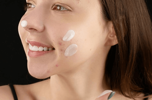 Routine minimaliste pour les peaux à imperfections – Stop à l’agression