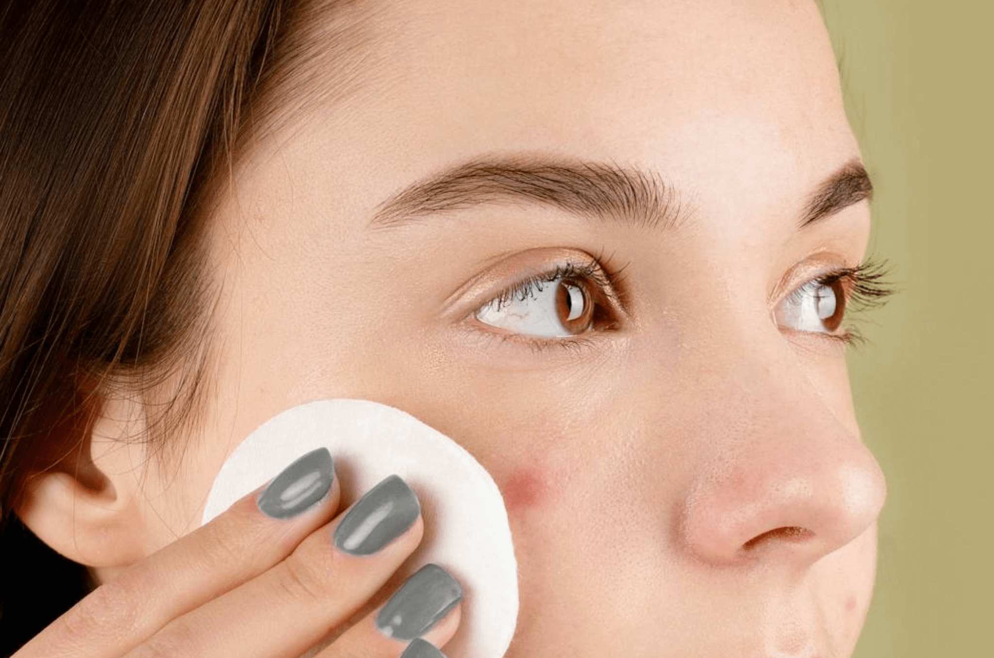 Peau sensible ET acné – Comment s’en sortir quand tout agresse votre visage ? Image