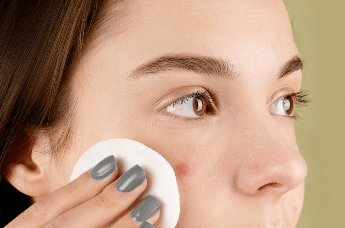 Peau sensible ET acné – Comment s’en sortir quand tout agresse votre visage ?
