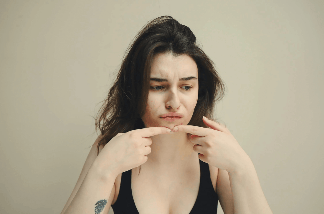 Pourquoi mon acné revient toujours au même endroit ?