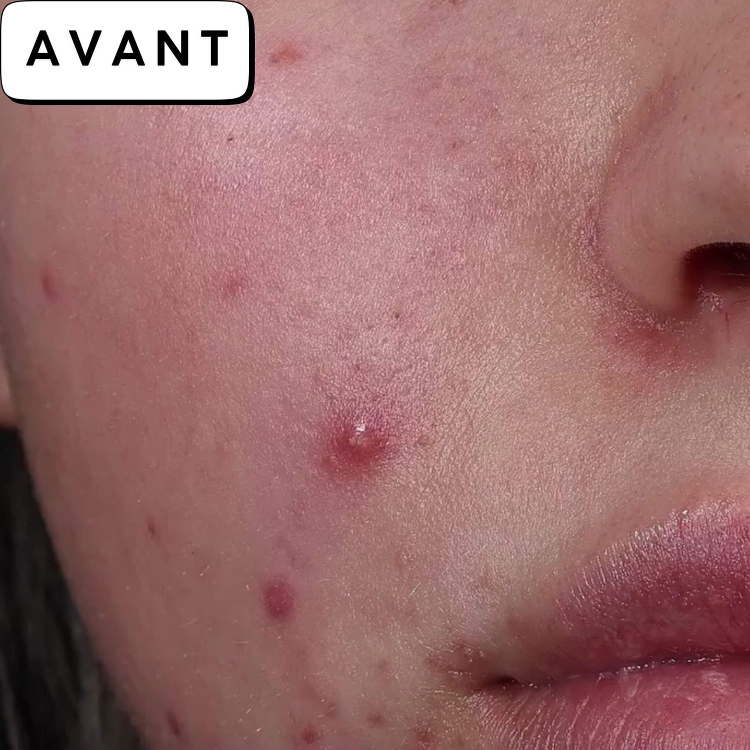 Avant