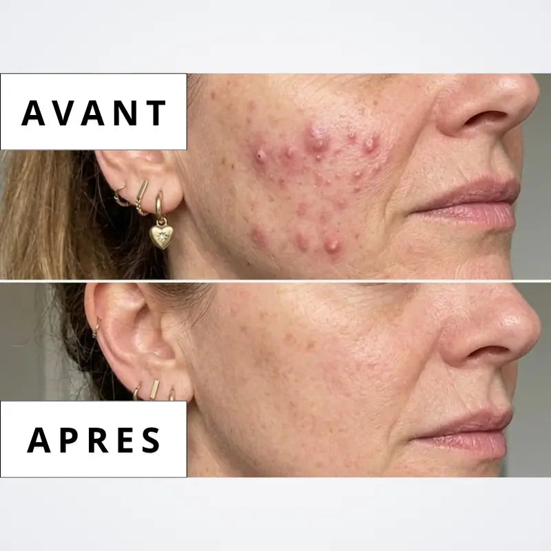 Calméa – Le bouclier ménopause ciblé qui relaie vos hormones protectrices pour retrouver la paix