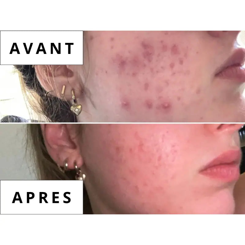 Calméa – Le bouclier d’anticipation ciblé pour retrouver la paix avant vos règles